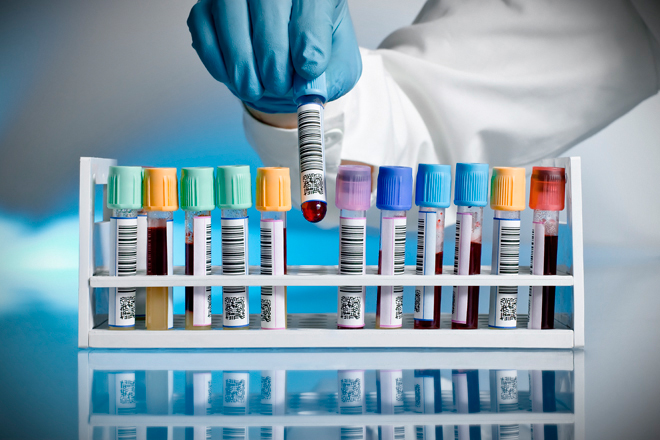 DRUG TESTING